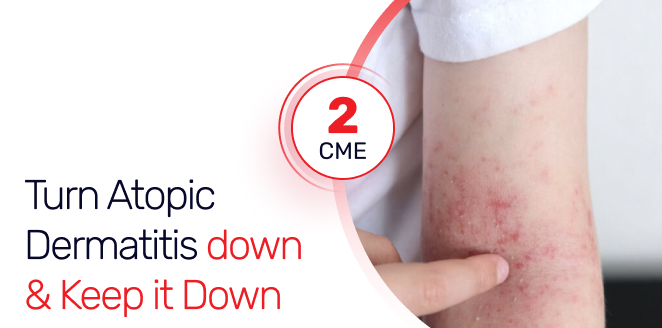 Turn Atopic Dermatitis down & Keep it Down