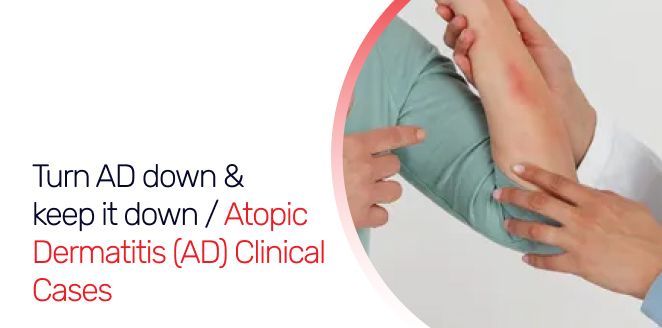 Turn AD down & keep it down / Atopic Dermatitis (AD) Clinical Cases