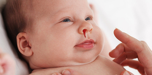 Approach to a child with bleeding