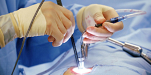 Cardiac Surgery (50 min About Medical Speciality)