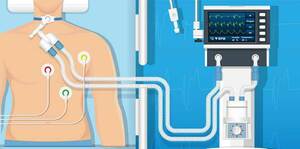 Introduction to Mechanical Ventilation