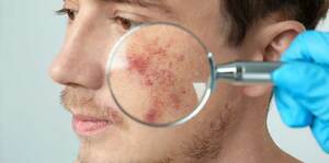 Dermatology Emergency Crash Course - Part 1