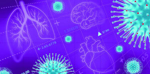 Proposed Management of Acute COVID-19 for Cardiovascular syndrome