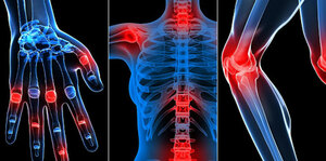 Rheumatology Data Interpretation