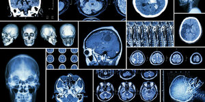 The Story Behind the Medical Imaging