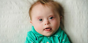 Down Syndrome