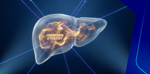 Hepatitis of Unknown Etiology, What's New?
