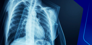 Chest x ray interpretation