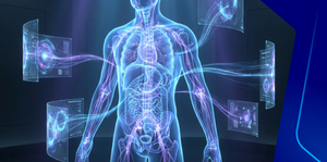 Connective Tissue Disease: SLE