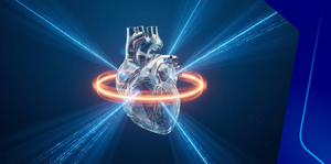 Approach to Patients with Suspected Angina Pectoris