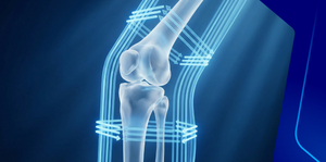 Current guidelines and best practices in managing RA