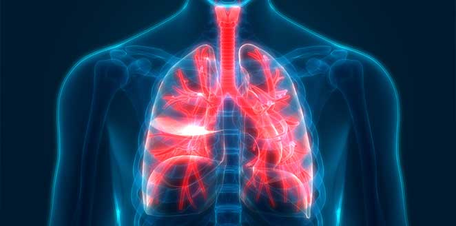 Diagnosis and Management of Acute Respiratory Failure