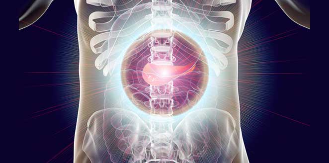 Acute pancreatitis