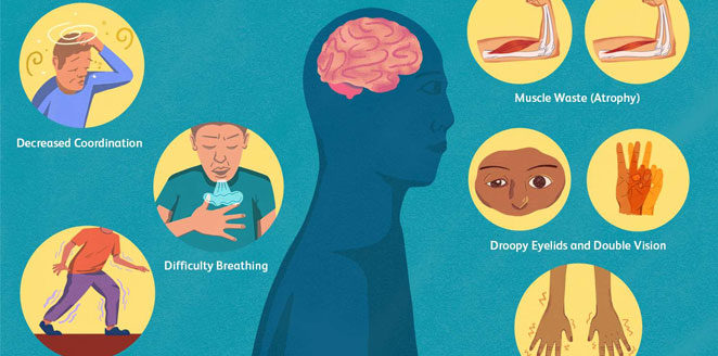 Approach to Neuromuscular Disorders