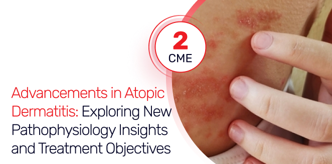 Advancements in Atopic Dermatitis: Exploring New Pathophysiology Insights and Treatment Objectives