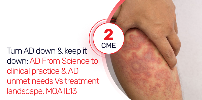 Turn Atopic Dermatitis Down and Keep it Down